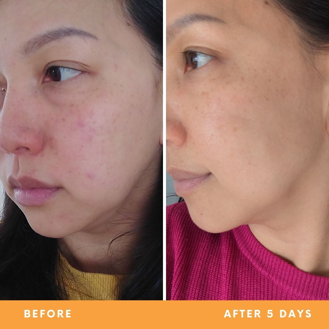 Le Calme Serum | Ultra-soothing, ultra-hydrating serum - Last Batch!