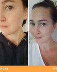 Christine's dull, tired skin results from using Be Fraiche skincare. Left (before) photo: photo of her face with dull, tired and dehydrated skin, right (after) photo: photo of her face with smoother, glowy, well-moisturised skin..