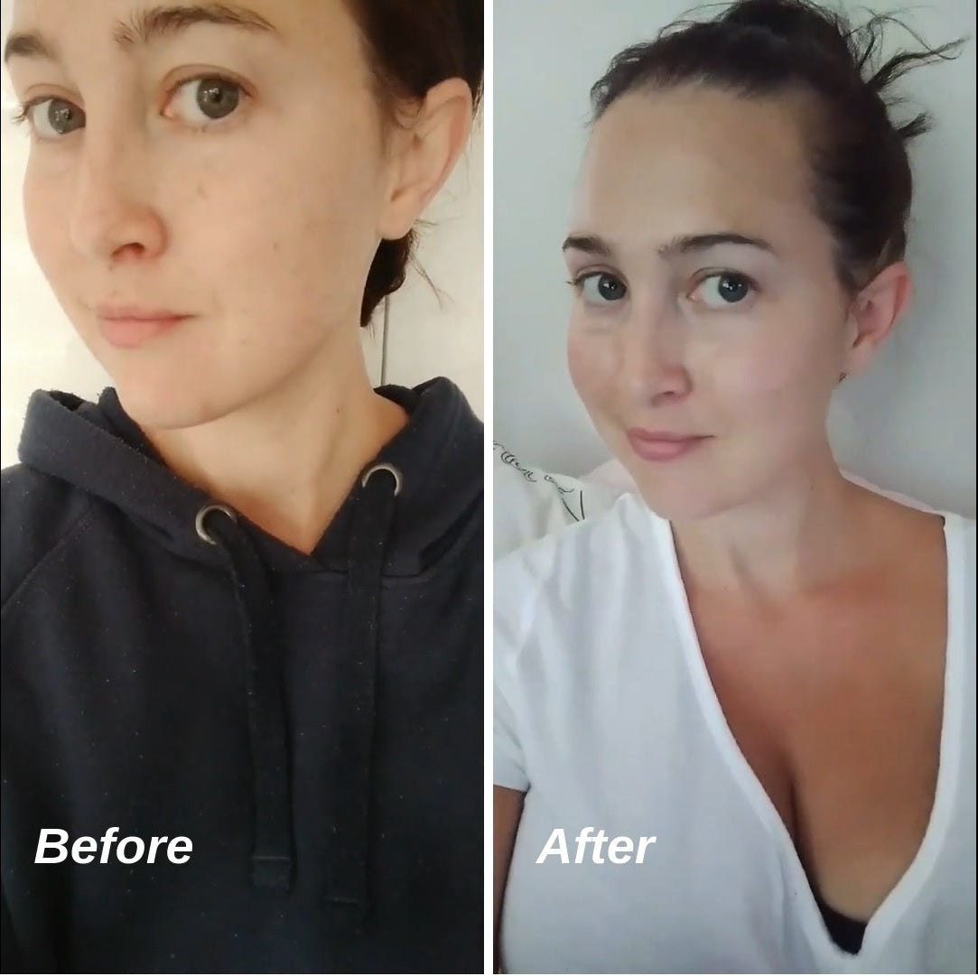Dull, tired skin instant results