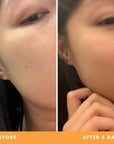 Fiona's oily, combination skin results from using Be Fraiche skincare. Left (before) photo: photo of her face with oily, bumpy complexion, right (after) photo: photo of her face with more balanced, even skin.