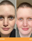 Shannah results from using Be Fraiche skincare. Left (before) photo: front photo of her face with uneven, bumpy skin, right (after) photo: front photo of her face smiling with much smoother, brighter and bouncier complexion.