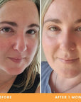 Jess' dry skin and redness results from using Be Fraiche skincare. Left (before) photo: photo of her face with red, dry skin, right (after) photo: photo of her face with smoother, calmer skin, reduced redness.